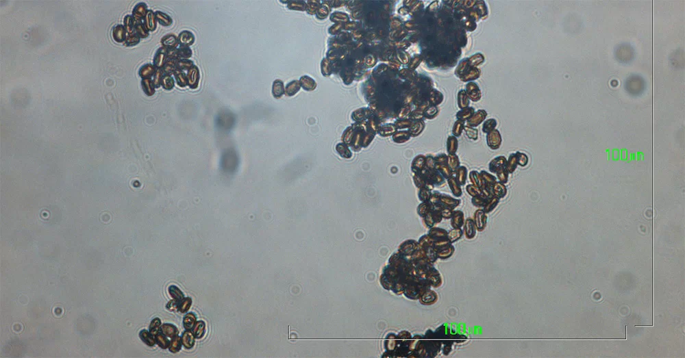 FitoFito1 cryptostroma corticale 3