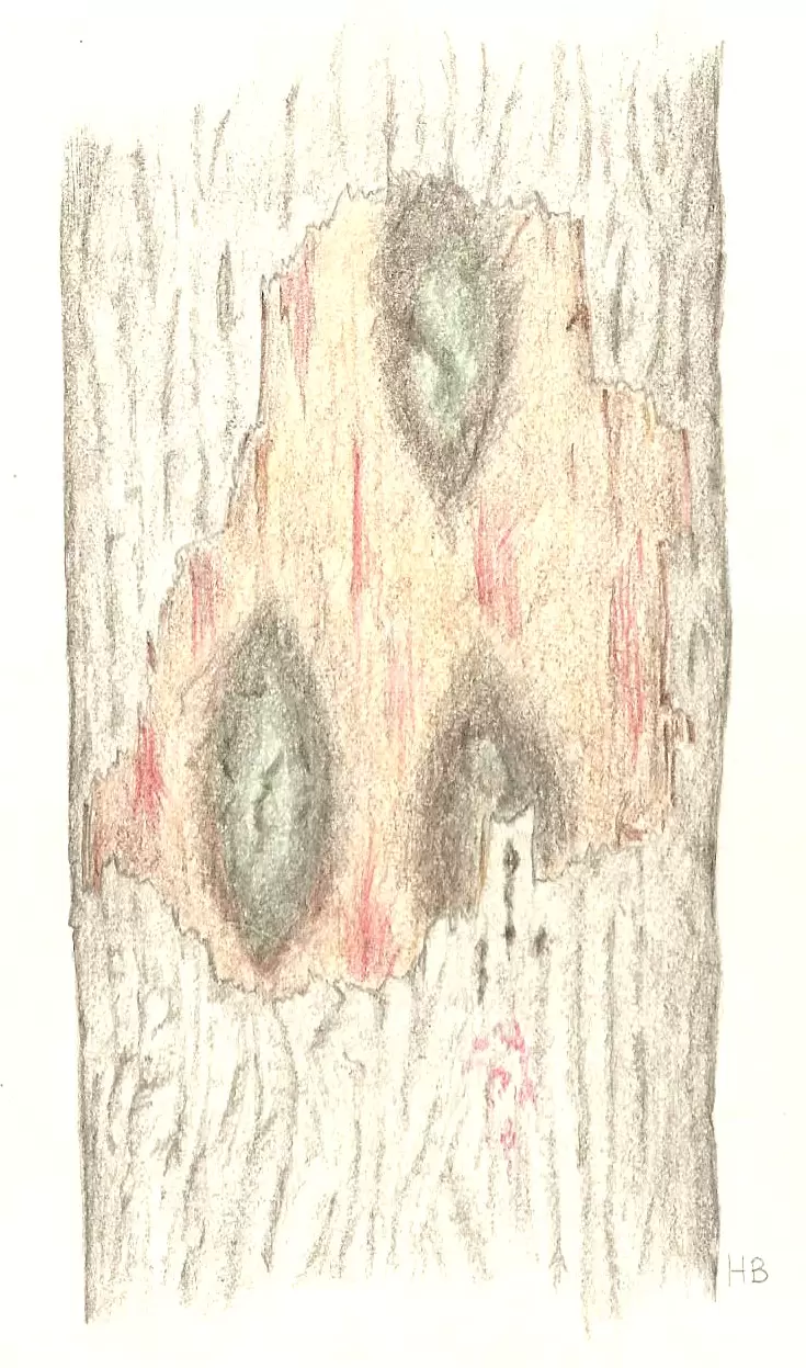 FitoFito1 cryptostroma corticale